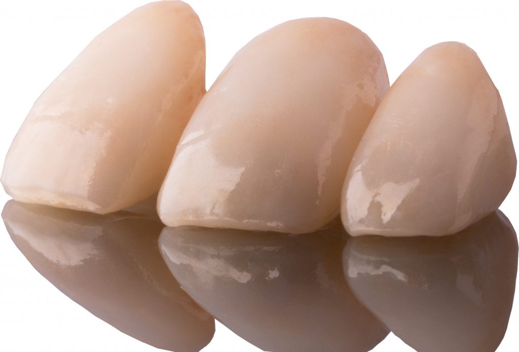 Dentalna klinika DentIN: cirkonske zobne krone