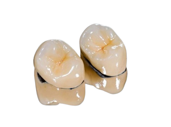 Dentalni centar DentIN, Zagreb: metalkeramičke zubne krunice.
