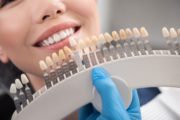 Dentalni centar DentIN, Zagreb: određivanje boje keramičkih ljuskica na temelju postojećih zubi.