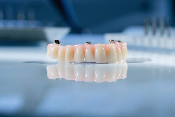 Dentalni centar DentIN, Zagreb: privremeni protetski rad All-on-4, načinjen od akrilata.