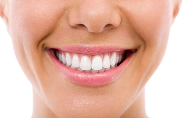 Dentalni centar DentIN, Zagreb: osmijeh djevojke, vrlo bijeli zubi, izbijeljeni.