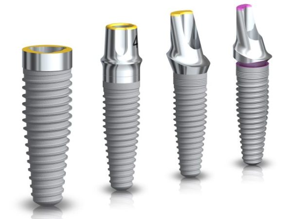 Dentalni centar DentIN, Zagreb: premium titanski zubni implantati Nobel Biocare.